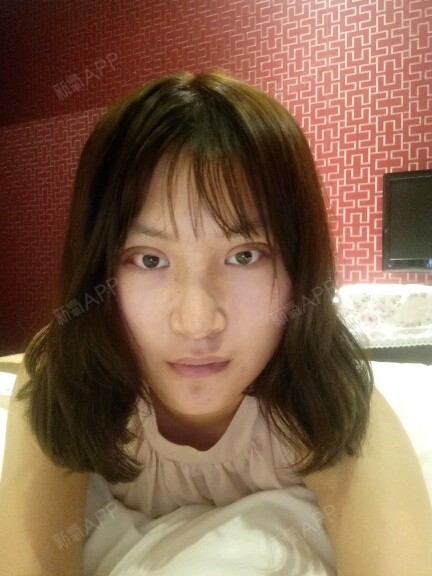不了了,就是鼻头鼻翼还有一点点大,希望可以消肿,我还去做了个发型图片