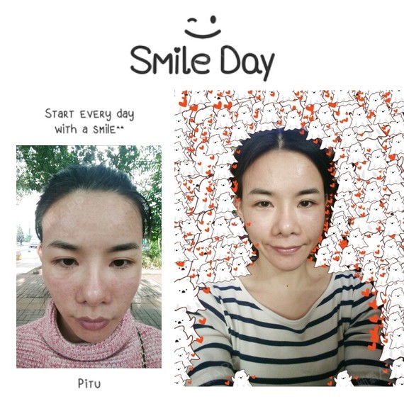 ... 儿 | 微整形 | 术后当自强 | 珠海同城 | 皮肤 | 水光针