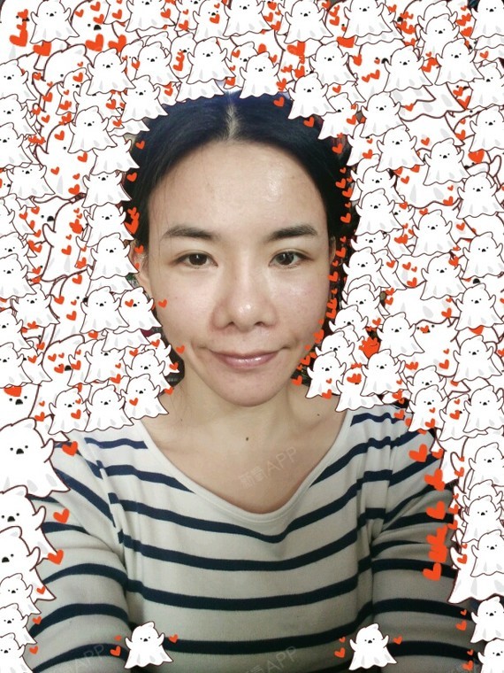 ... 儿 | 微整形 | 术后当自强 | 珠海同城 | 皮肤 | 水光针