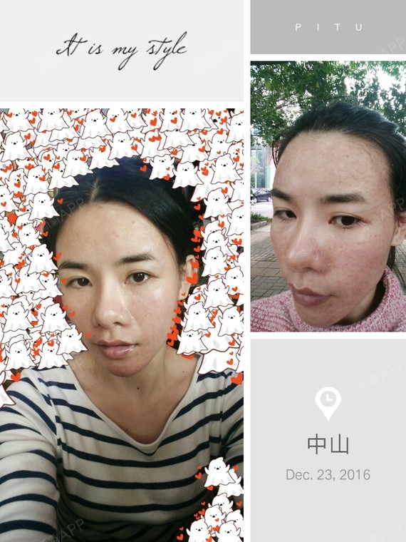 ... 儿 | 微整形 | 术后当自强 | 珠海同城 | 皮肤 | 水光针