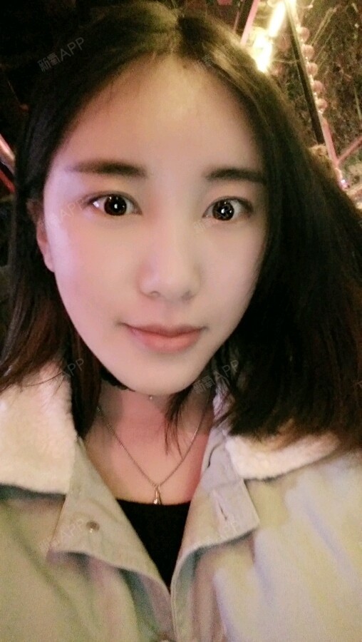 cassie汐汐自体脂肪全脸填充术后第6天美丽日记_新氧