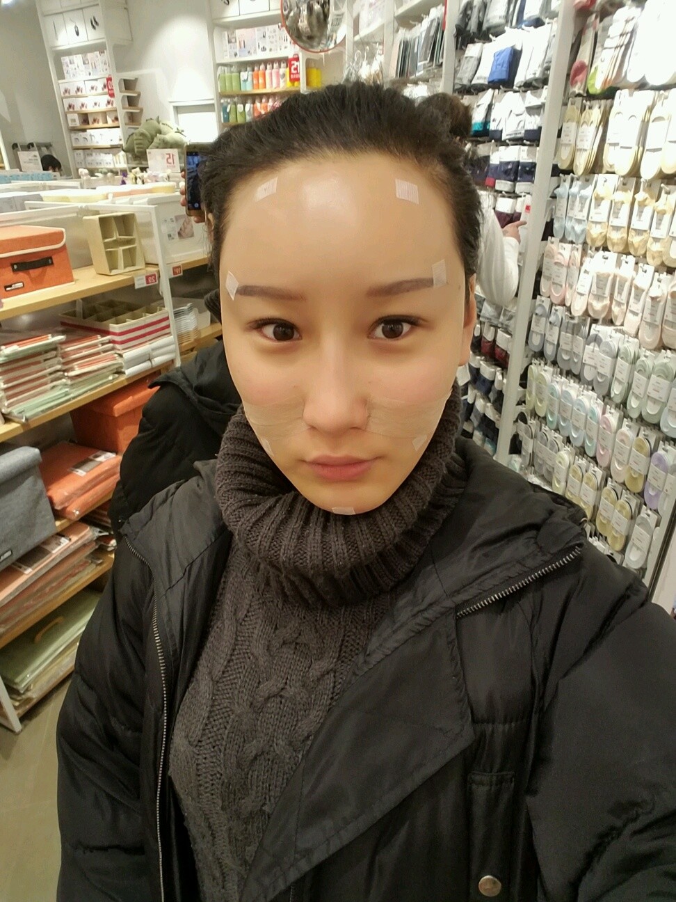 自体脂肪丰额头怎么样_恢复过程_效果如何_princess_1