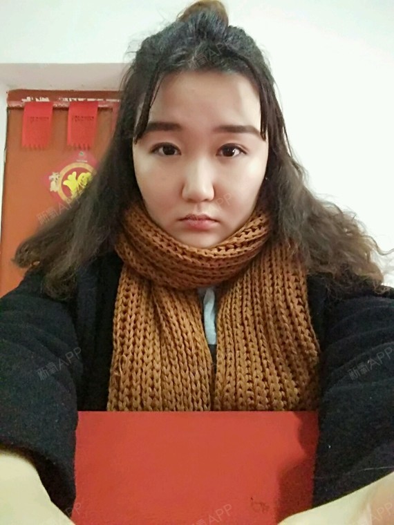 我的鼻子一直很塌,整个脸侧面看比较平,希望鼻