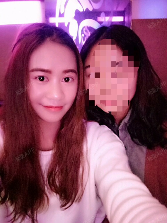 我是一玫小脸大眼的妹子,鼻子真的很丑,严重影