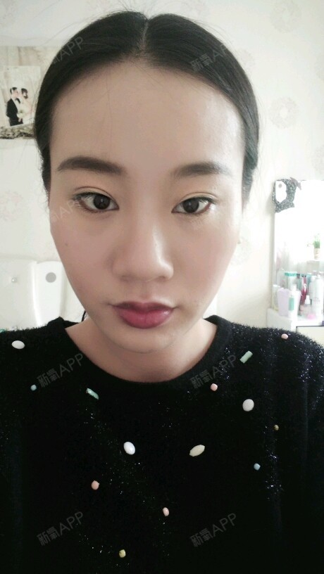 一个星期了,没什么明显变化,两侧咬肌有点酸痛,没有力气