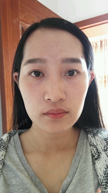 顶着一张大饼脸是什么样的体验?明明很瘦,也会显得很