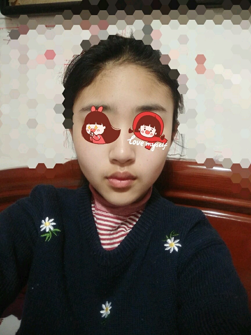 顶着一张大饼脸是什么样的体验?明明很瘦,也会显得很