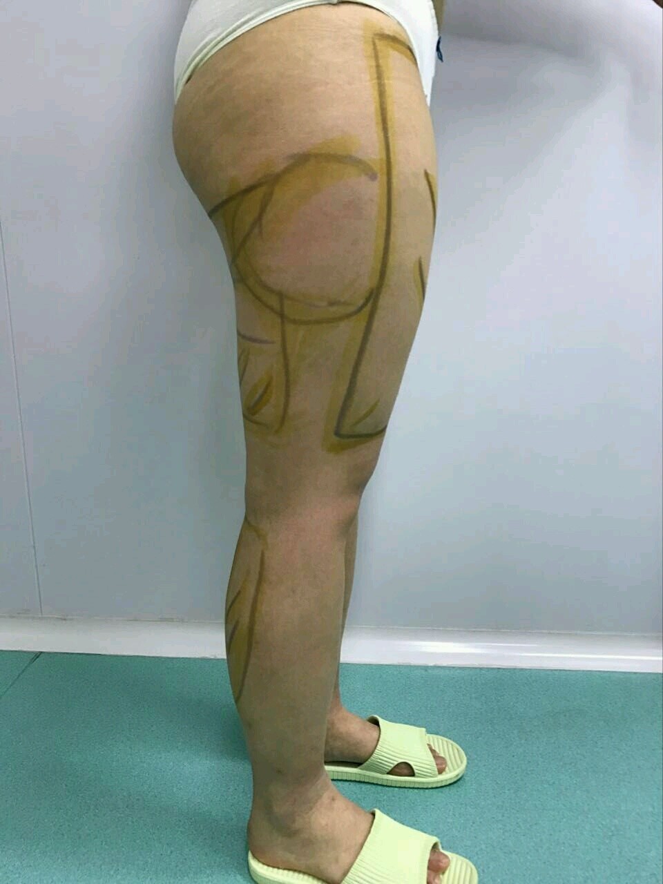 不就可以了吗以后会有后遗症的啊…天晓得我节过食吃过减肥药去过健身