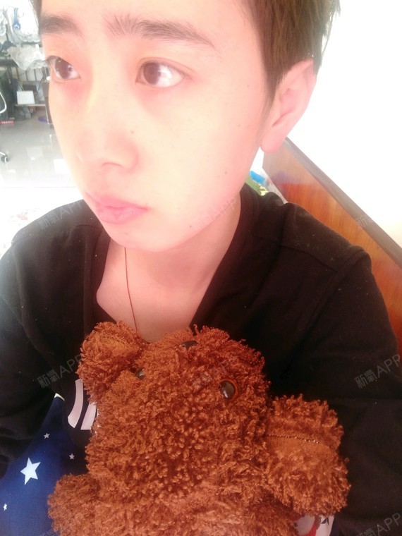 想开眼角然后双眼皮眼睛变大,不找埋线要永久