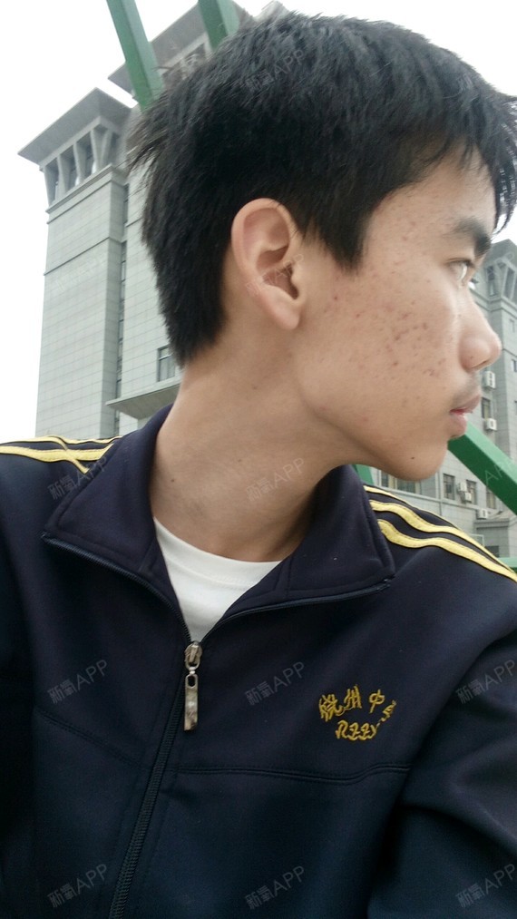颞下颌关节紊乱,怎么办啊啊啊,脸都歪了