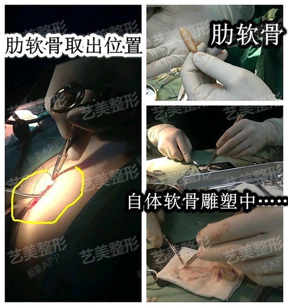 至于这个概念里面主要的理念就是鼻尖的三角架理论,通过三角架三条臂