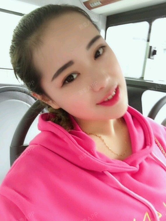 ――深圳联合丽格医疗美容――这是我做过的双