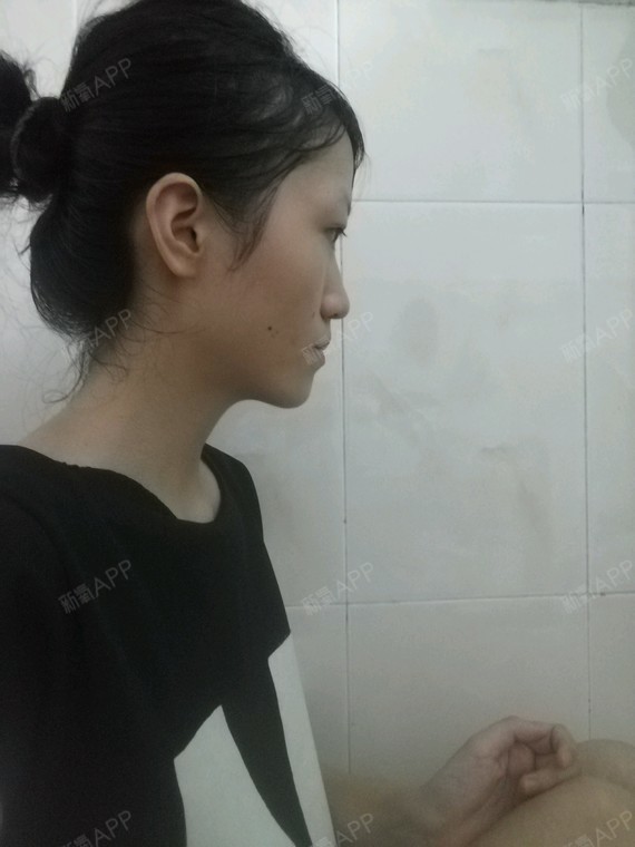 个人属于正脸还行,侧脸不好看的。想知道面部