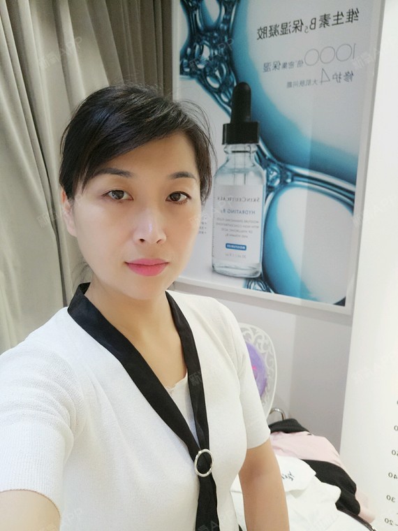 看到效果了,复查时忍不住在医院里自拍了一张