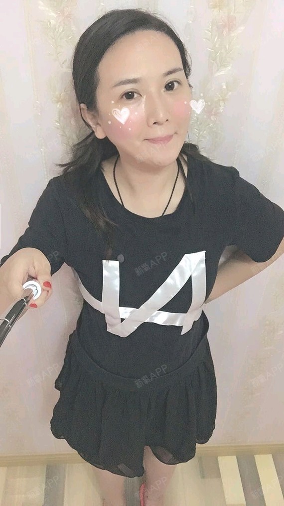 Miss羊羊吸脂瘦腹部第47天美丽日记-新氧美容