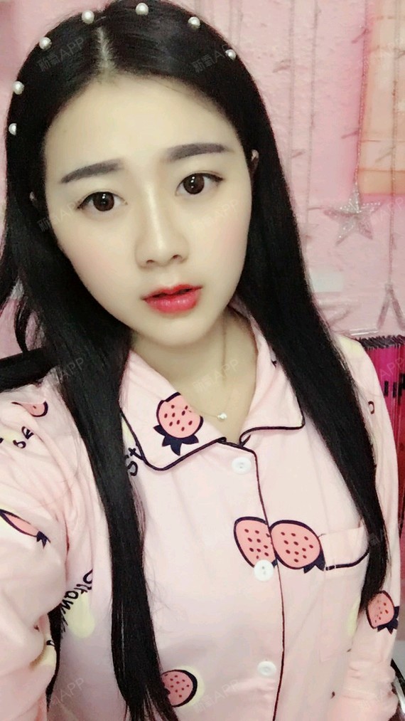 新氧-小九九妹|玻尿酸|术后当自强|重庆同城|玻视频隆鼻的吵架尿酸图片