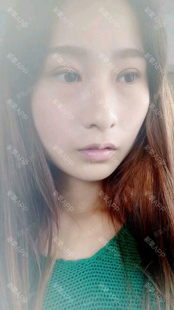 【贵阳美贝尔】双眼皮做宽些还是窄些好看?很