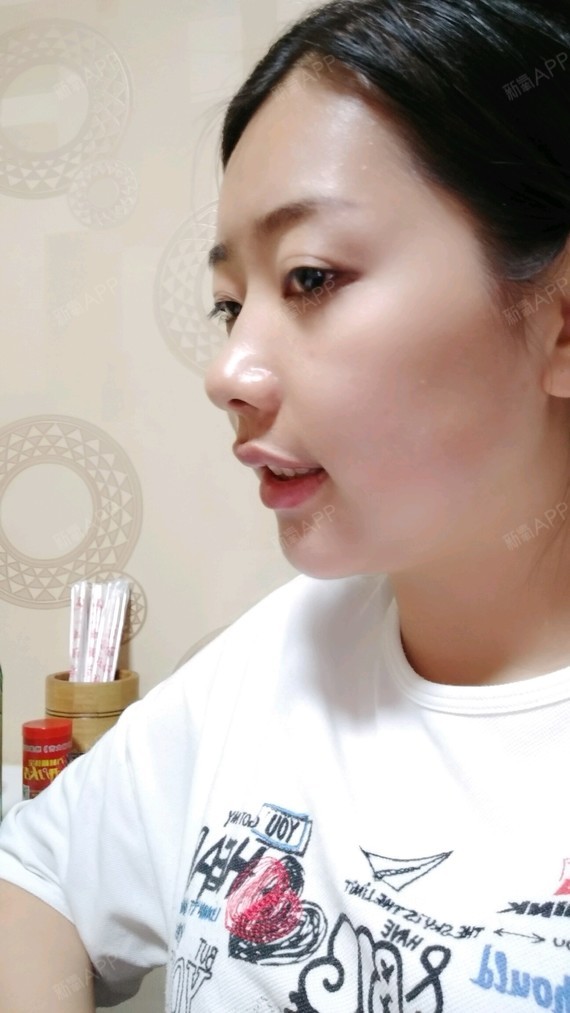 侧脸看下巴不是很长,脸有点肉哈哈