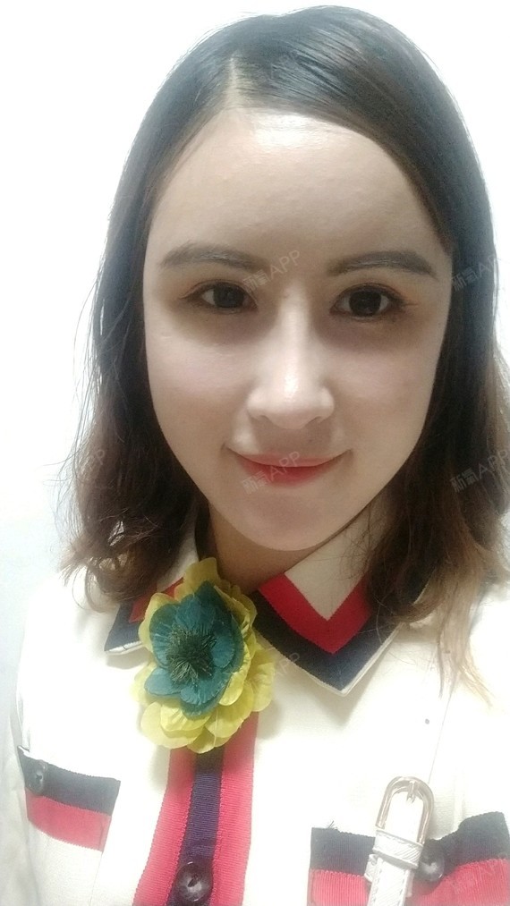 爱吃胡萝卜的nymph宽鼻矫正第15天美丽日记-