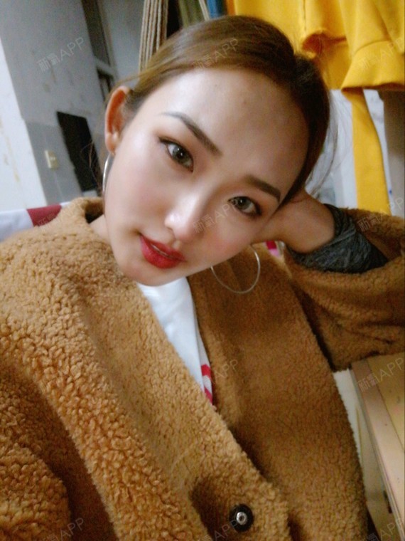 honey酱取颊脂垫瘦脸第141天美丽日记-新氧美v瘦脸肚子视频下载减健身操图片