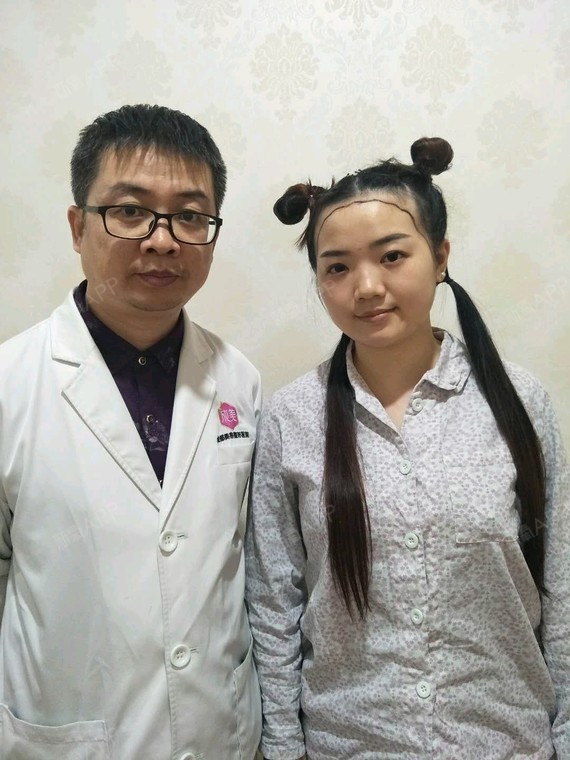 #种植发际线效果是暂时还是永久的?#自从大幂