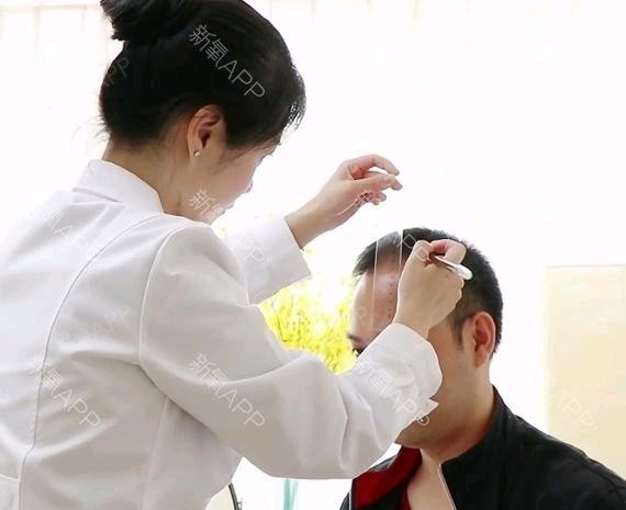 [种植发际线手术术后0效果]头发是人的第二修