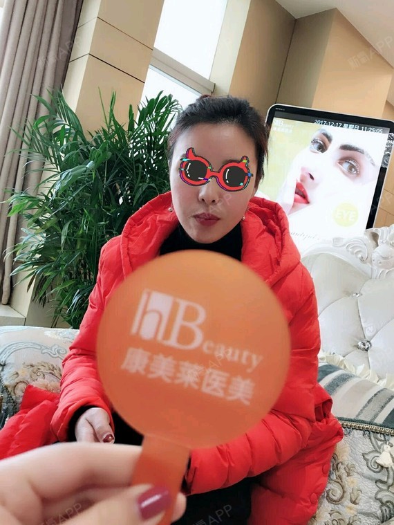 【武汉康美莱-自体脂肪填充三个月】当今社会