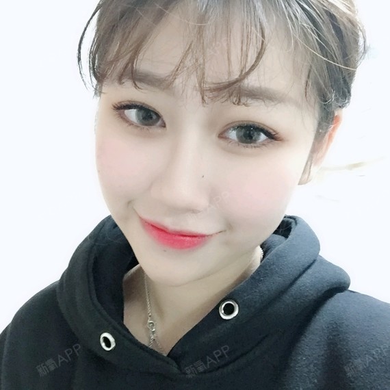 bulingbuling大眼睛定点双眼皮第261天美丽日记