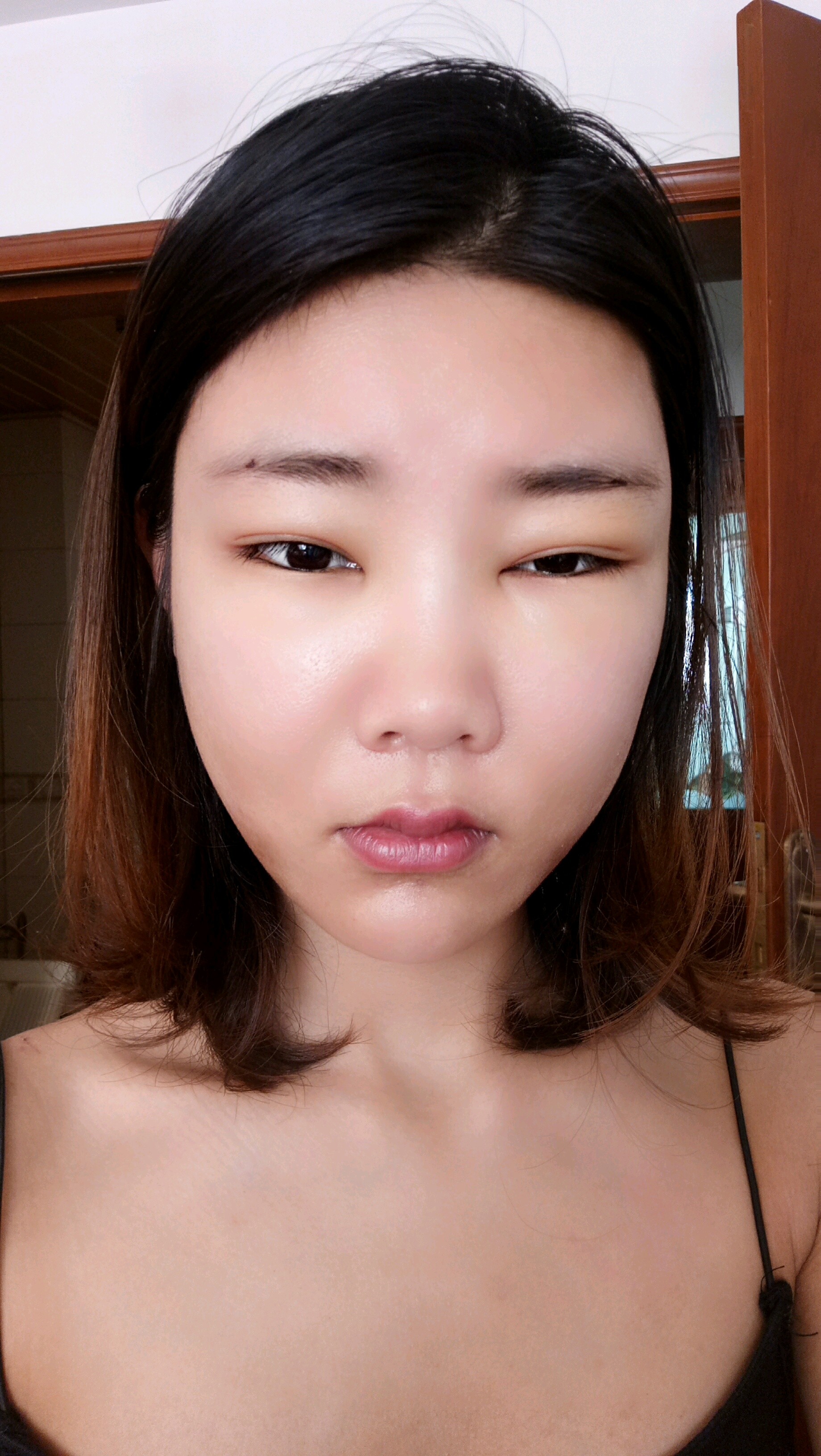 术后第7天就感觉脸部紧绷感减弱了,摸起来没那么硬了,现在看外侧嗯
