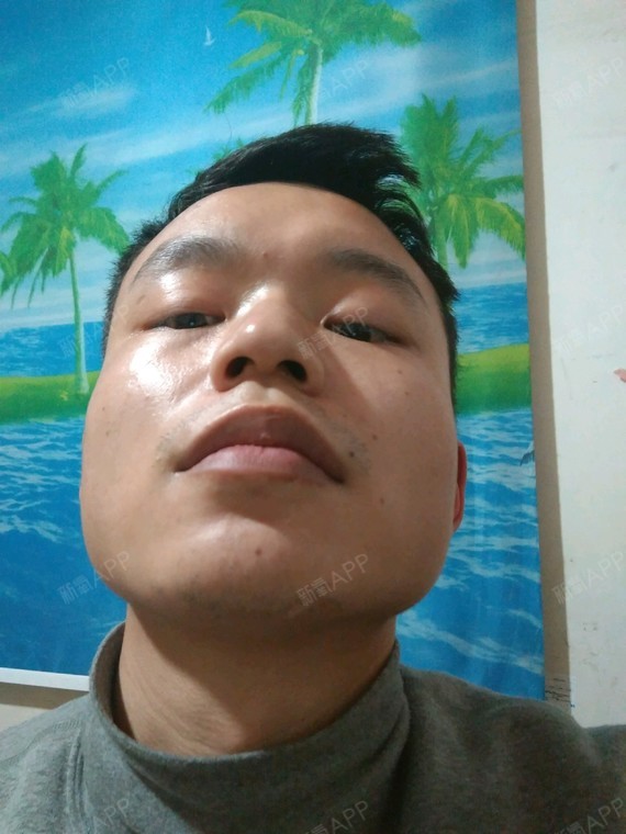 新氧昵称:勤劳得小蜜蜂年龄:25岁身高:180cm职