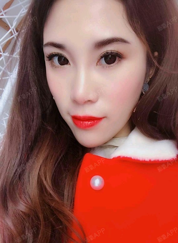 【上海万众微整带来的改变】顾客是九月份在我