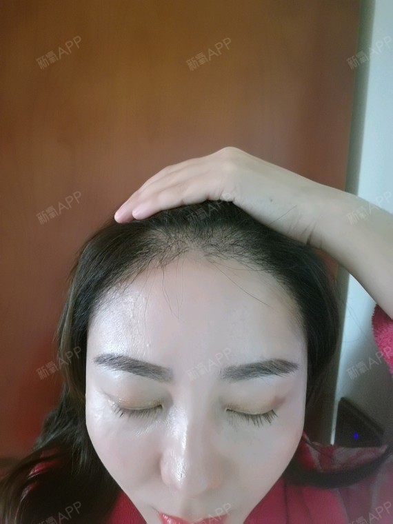 氧气6580091504310775种植眉毛第125天美丽