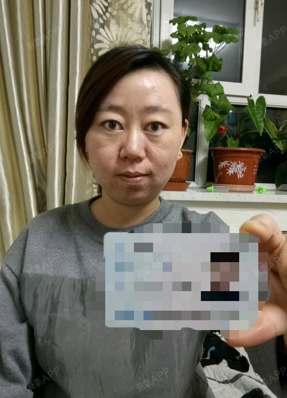 脸上肉很多,一直都感觉自己没下巴而且双下_圈