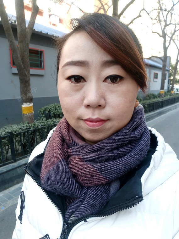 脸上肉很多,一直都感觉自己没下巴而且双下巴