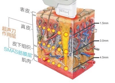 林珑