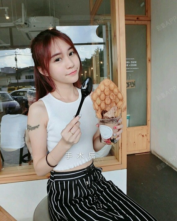 【重庆星艺美--石思银】眼袋切除术是一种外科