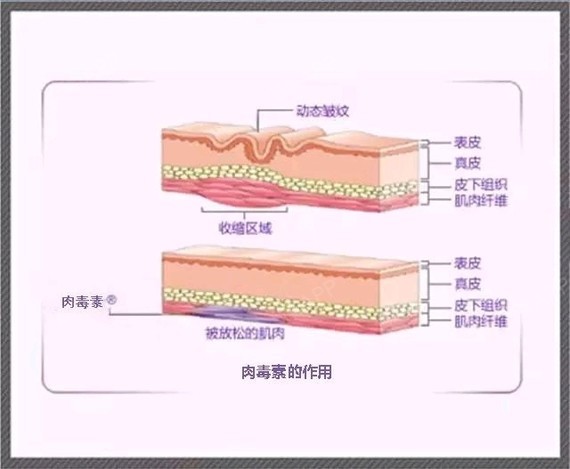 爱美的女孩子都有这种感受,小腿粗真是要人命