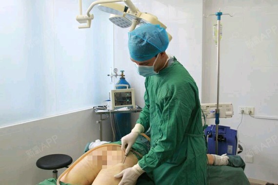 吸脂8590581512550787脂肪瘦大腿第0天美丽燃烧氧气的胶囊图片