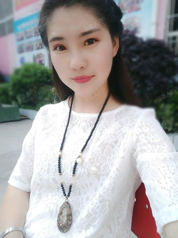 我的眼睛看看这是开了眼角吗?前两张术前,后面