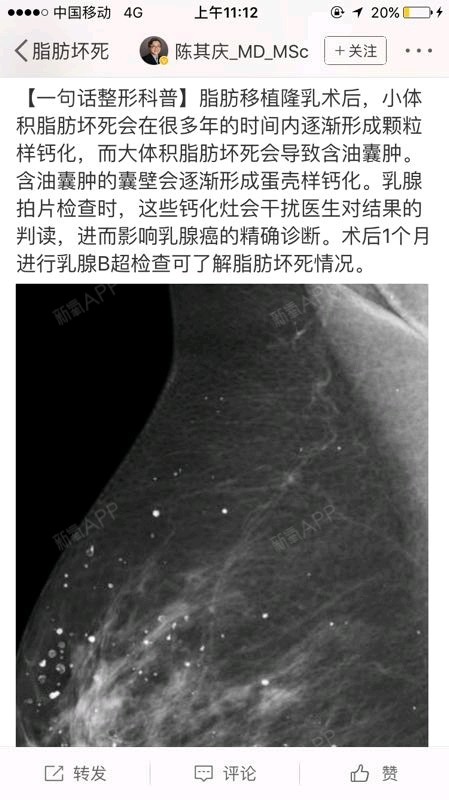 自体脂肪填充有结节怎么办需要取出来吗?听别