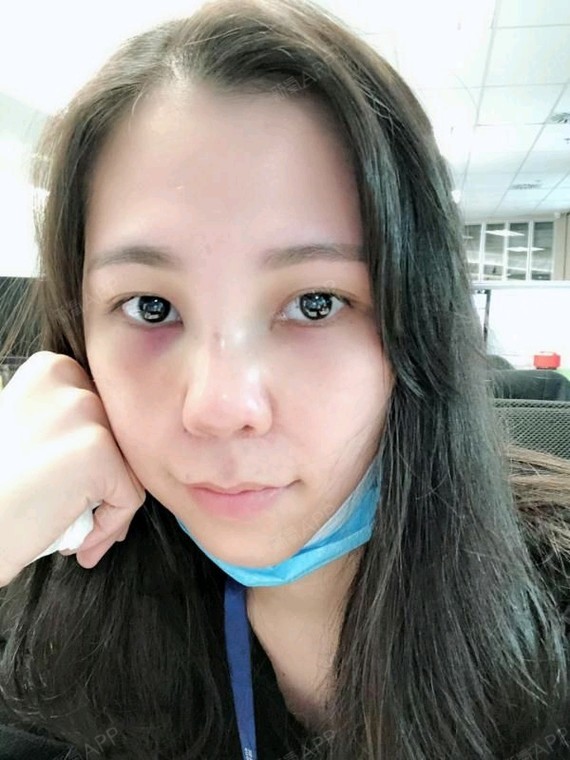 女生长了个这种大鼻子真悲哀(笑起来更大)!