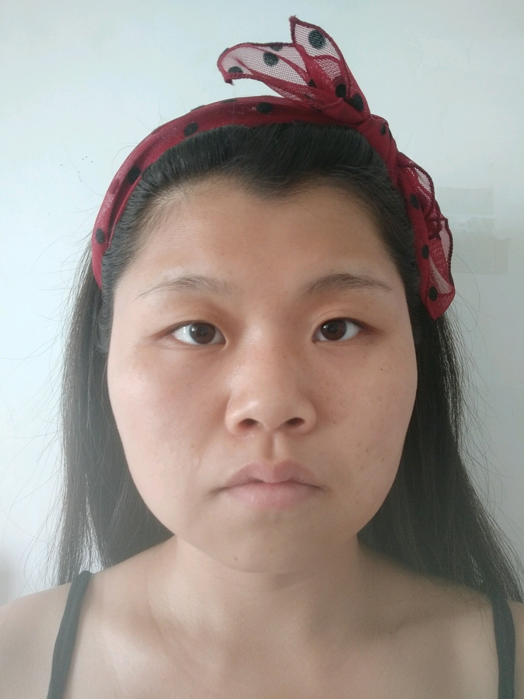 感觉自己像个男的,还是丑男[:9][:9]_圈子-新氧美容