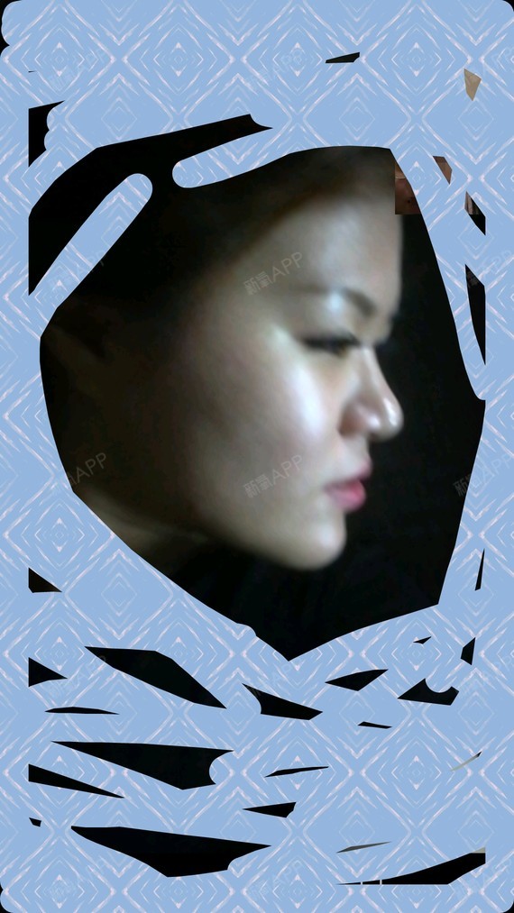 除了眉骨的问题,还想做法令纹,川字纹,瘦脸,发际