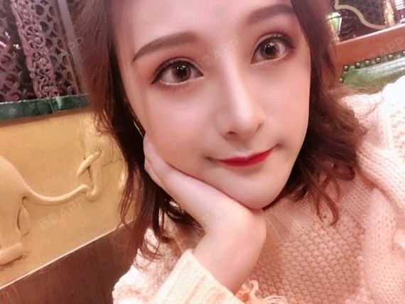 鼻小柱延长手术恢复时间跟个人体质和术后护理