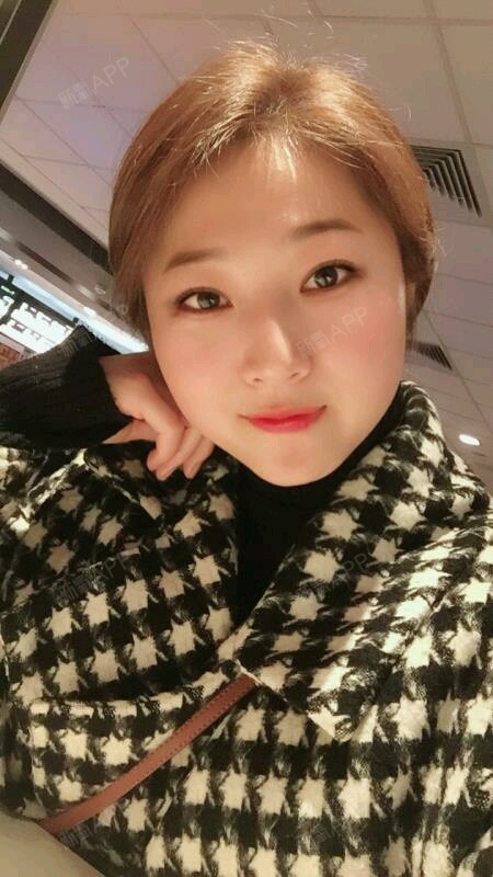 【美莱整形】再次大V线线雕多次进行大V线线