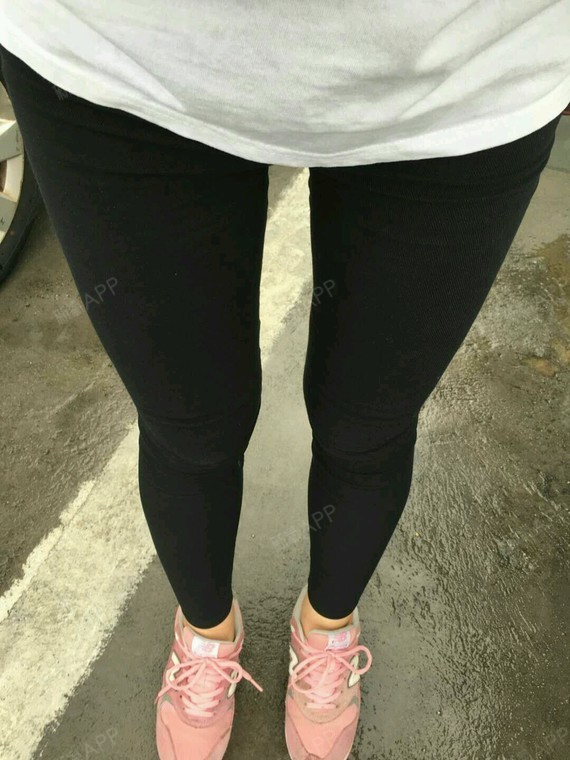 坚强的多肉喔吸脂瘦大腿第52天美丽日记-新氧