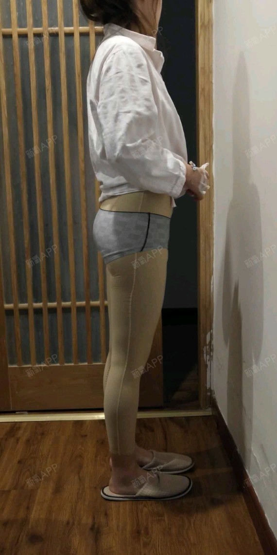 吸脂瘦大腿|吸脂瘦小腿|美体减肥|术后当自强|上海同城