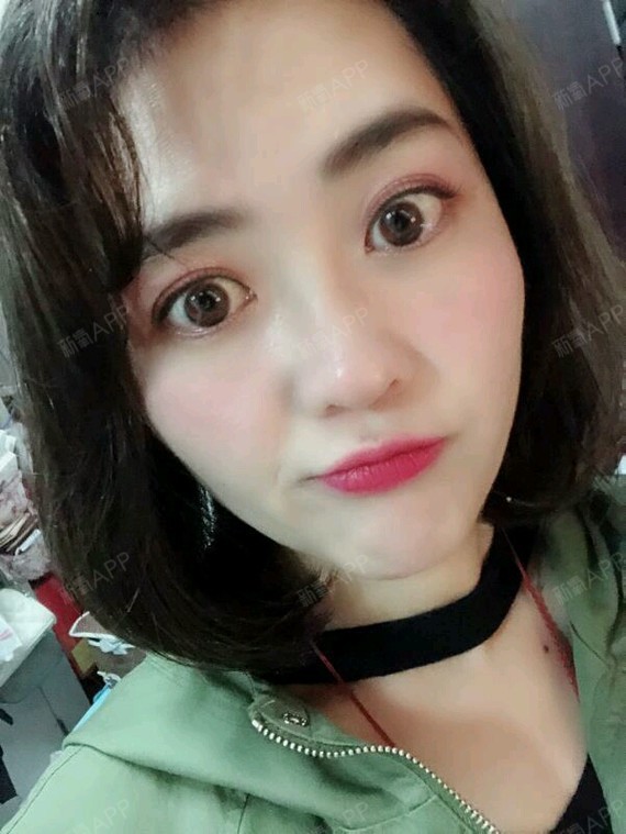 【美莱整形】黄褐斑治疗后的注意事项1、做完