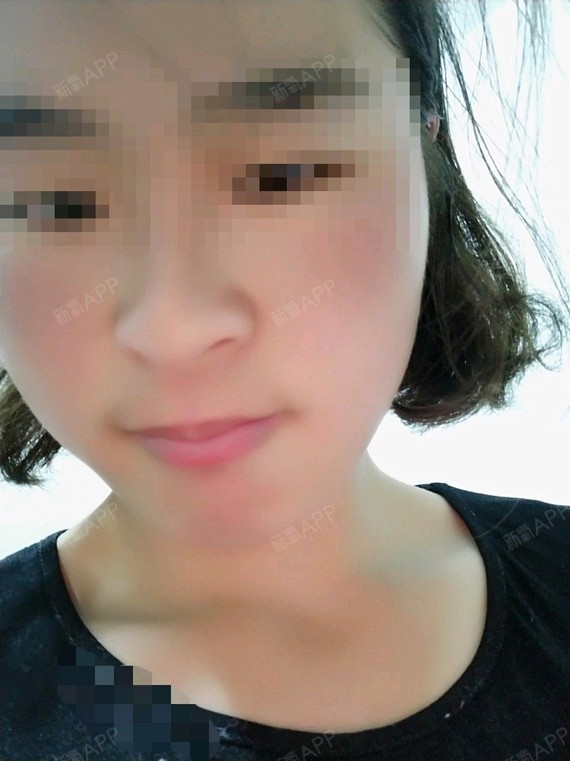 处女膜修复好不好_效果图_粉红色的童年处女膜修复术