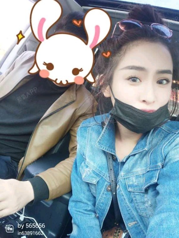 肤白貌美大长腿下一句是自体脂肪全脸填充第1